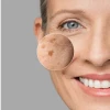 Janssen Dark Spot Perfector | Serumas pigmentinių dėmių pašalinimui 30 ml