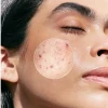 Janssen Cosmetics Purifying BHA Serum | Serumas su salicilo rūgštimi probleminei odai, 30 ml