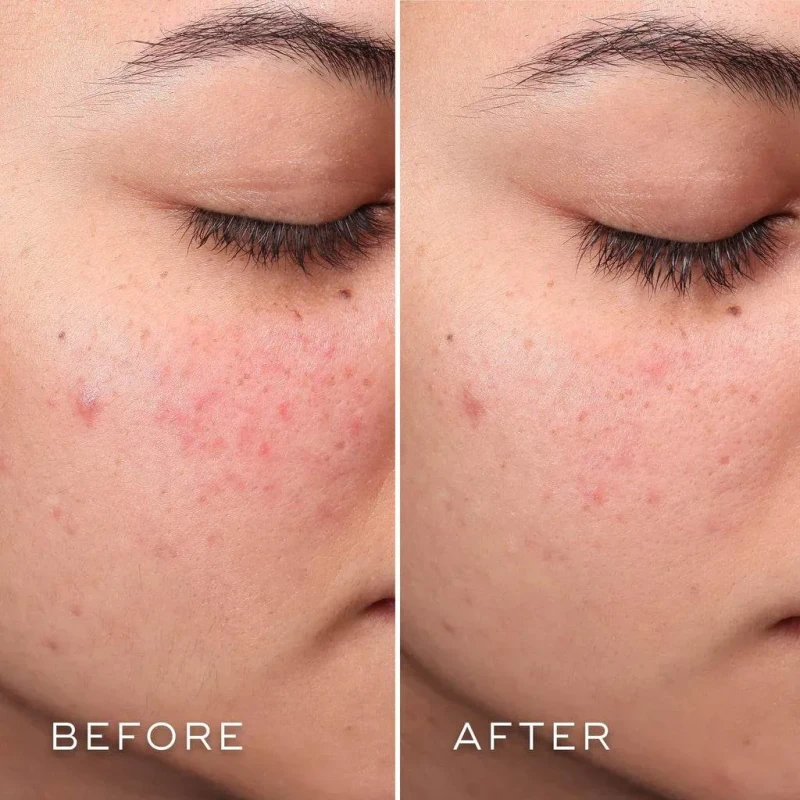 Medik8 Press & Clear Refill | Pildomas BHA tonikas probleminiaiems odos tipams 150 ml